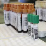 Rimini, prevista per il 29 maggio la campagna di screening sierologico